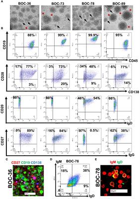 Characterization of latently infected EBV+ antibody-secreting B cells isolated from ovarian tumors and malignant ascites